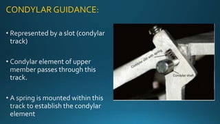 Condylar Rods Articulators in dentistry | PPTX