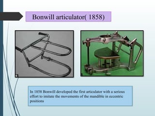 Bonwill articulation in complete dentures chapter | PPTX