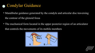 159
Condylar Guidance
• Mandibular guidance generated by the condyle and articular disc traversing
the contour of the glenoid fossa
• The mechanical form located in the upper posterior region of an articulator
that controls the movements of its mobile members
 