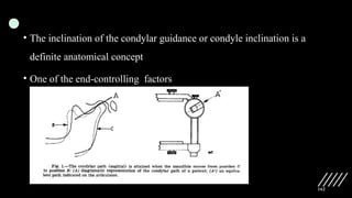 162
• The inclination of the condylar guidance or condyle inclination is a
definite anatomical concept
• One of the end-controlling factors
 