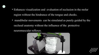 16
• Enhances visualization and evaluation of occlusion in the molar
region without the hindrance of the tongue and cheeks.
• mandibular movements can be simulated as purely guided by the
occlusal anatomy without the influence of the protective
neuromuscular reflexes.
 