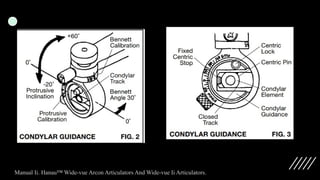 Manual Ii. Hanau™ Wide-vue Arcon Articulators And Wide-vue Ii Articulators.
 