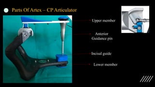 Parts Of Artex – CP Articulator
Upper member
Lower member
Incisal guide
Anterior
Guidance pin
 