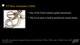 42
ET Starr Articulator (1868)
• One of the fixed condylar guide instruments.
• The lower plate is held in position by elastic bands.
 