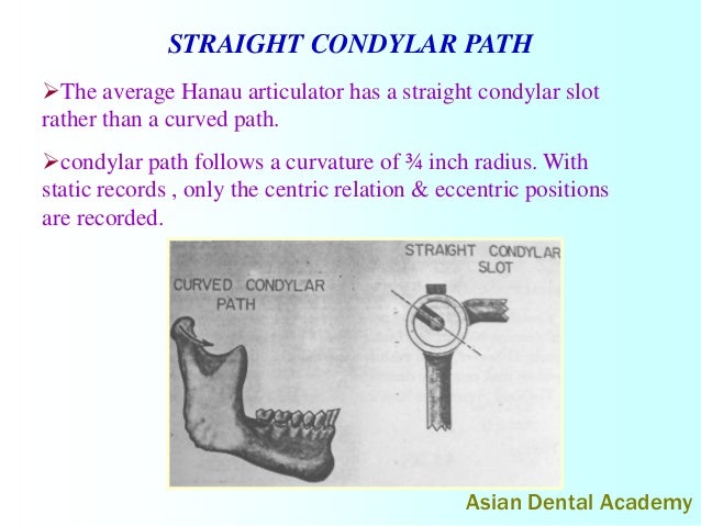 Straight Line Articulator : Articulators in complete dentures by asiandentalacademy
