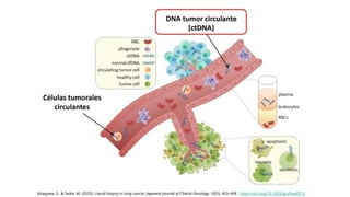 Innovative Liquid Biopsy Techniques for Early Lung Cancer Diagnosis and ...