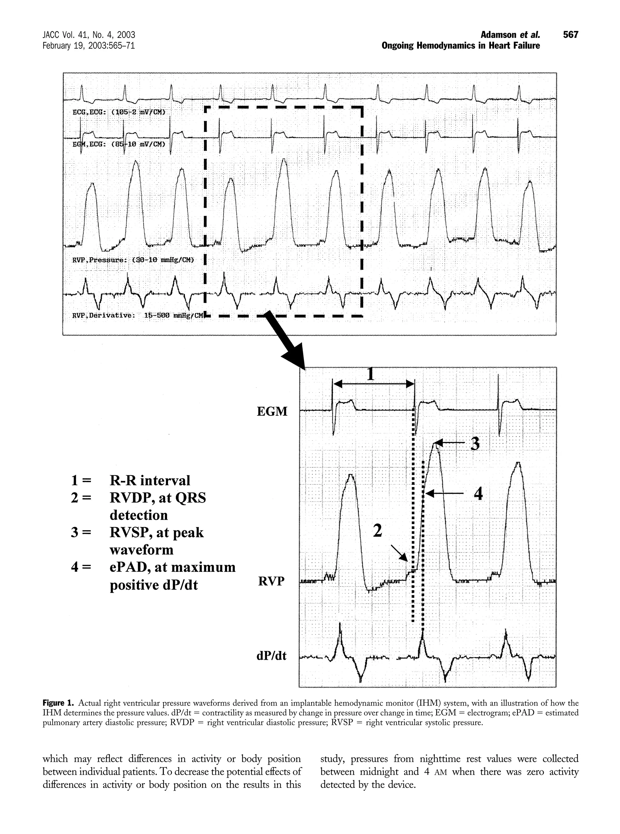 which may reﬂect differences in activity or body position
between individual patients. To decrease the potential effects of
differences in activity or body position on the results in this
study, pressures from nighttime rest values were collected
between midnight and 4 AM when there was zero activity
detected by the device.
Figure 1. Actual right ventricular pressure waveforms derived from an implantable hemodynamic monitor (IHM) system, with an illustration of how the
IHM determines the pressure values. dP/dt ϭ contractility as measured by change in pressure over change in time; EGM ϭ electrogram; ePAD ϭ estimated
pulmonary artery diastolic pressure; RVDP ϭ right ventricular diastolic pressure; RVSP ϭ right ventricular systolic pressure.
567JACC Vol. 41, No. 4, 2003 Adamson et al.
February 19, 2003:565–71 Ongoing Hemodynamics in Heart Failure
 