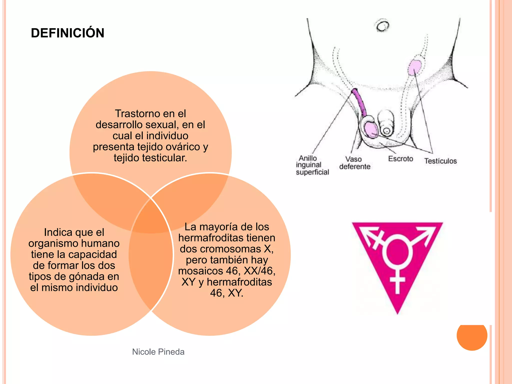 Hermafroditismo Verdadero En Humanos PPTX Hermafroditismo Verdadero En Humanos PPTX