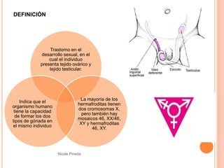 Hermafroditismo Verdadero en Humanos | PPTX