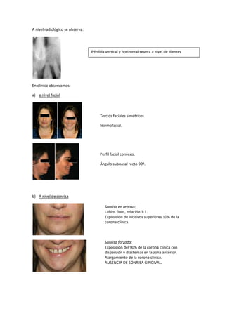 A nivel radiológico se observa:




                                  Pérdida vertical y horizontal severa a nivel de dientes
                                  anteriores.




En clínica observamos:

a) a nivel facial



                                       Tercios faciales simétricos.

                                       Normofacial.




                                       Perfil facial convexo.

                                       Ángulo subnasal recto 90º.




b) A nivel de sonrisa

                                          Sonrisa en reposo:
                                          Labios finos, relación 1:1.
                                          Exposición de Incisivos superiores 10% de la
                                          corona clínica.



                                          Sonrisa forzada:
                                          Exposición del 90% de la corona clínica con
                                          dispersión y diastemas en la zona anterior.
                                          Alargamiento de la corona clínica.
                                          AUSENCIA DE SONRISA GINGIVAL.
 
