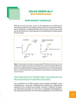 SALUS KEDOS No.7
                             BACTERIOLOGÍA

                    MARCADORES TUMORALES

DNA de un tumor de seno, como es de esperarse con el DNA de los
leucocitos los tres Cp son similares, pero en el tumor los Cp para HER-2 y
topo II presentan un desplazamiento del Cp que se da tres ciclos antes
que el de la ábúmina, lo que equivale a una amplificación de estos genes
de ocho veces.




Figura 7. Determinación del número de copias usando PCR múltiple en tiempo real con tres
colores. Se comparan los Cp de los tres genes Her-2, topo II y el gen de albúmina, en
leucocitos y en células tumorales de seno. En leucocitos los Cp son similares para los tres
genes, en el tejido tumoral hay un desplazamiento de tres ciclos en el Cp para HER-2 y
topo II, que se da más temprano, lo que representa una amplificación de estos genes de 8
veces en el tumor.



PCR MÚLTIPLE EN TIEMPO REAL EN ANÁLISIS DE
MUTACIONES EN TUMORES SÓLIDOS
Las mutaciones en el DNA pueden incluir grandes rearreglos, como
traslocaciones, inversiones, amplificaciones, deleciones y alteraciones
pequeñas como mutaciones puntuales, inserción o deleción de bases.
Las alteraciones grandes son comunes en neoplasias hematológicas y
por lo general se estudian con técnicas de citogenética. En contraste, las

                                                                                              95
 