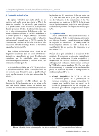 72 Rev Estomatol Herediana. 2015 Ene-Mar;25(1).
9. Evaluación de la vía aérea
	 La apnea obstructiva del sueño (AOS) es un
trastorno del sueño grave que afecta al 5% de la
población mundial. Se caracteriza por ronquidos
y se puede definir como el cese de la respiración
durante el sueño, debido a la obstrucción mecánica
por el retro-posicionamiento de la lengua en las vías
aéreas, exceso de tejido en la vía aérea superiores, o
el colapso parcial de la tráquea. Debido a las nuevas
técnicas de imágenes de diagnóstico, evaluación
tridimensional generada por la TCCB, permite la
cuantificación volumétrica 3D de las vías aéreas más
afectadas o estrechas a lo largo de toda la trayectoria
espacial de las mismas (3).
	 Los valores volumétricos serán útiles en el
diagnóstico diferencial para los casos ortodonticos-
quirurgicos, especialmente en casos de deficiencia
esquelética de la mandíbula, pues avances
mandibulares puede aumentar el volumen de las vías
respiratorias (30)(Figura 7).
	 Apesar de la posibilidad que la TCCB proporcione
la medición volumétrica de las vías respiratorias, no
hay estudios que demuestren que se puede utilizar
como una herramienta precisa para diagnosticar la
AOS (11).
	 Estudios recientes (31,32) indican que la
disminución de la dimensión de la vía aérea en la
zona del paladar blando, debido al aumento del
volumen del mismo debe de ser tomado en cuenta en
la planificación del tratamiento de los pacientes con
AOS. Por otro lado, Alves y col. (33) demostraron
que la evaluación de las dimensiones de las vías
respiratorias por medio de la TCCB de la faringe,
fueron significativamente mayores en los respiradores
nasales que en pacientes con respiración bucal(Figura
8, 9).
10. Superposiciones
	 Una de las tareas más difíciles en la ortodoncia es
la desintegración de los componentes de crecimiento
morfológicos dentales y esqueléticos que nos brindan
la respuesta al tratamiento. La superposición de
telerradiografías laterales ha sido la base en la
cuantificación de los cambios de tratamiento y el
crecimiento (34).
Pueden ser de gran utilidad en la evaluación de los
resultados de ortodoncia y ortopedia, especialmente
en los casos quirúrgicos (cirugía ortognática) y
ortopedia en los casos de: asimetrías, discrepancias
anteroposterior, verticales y transversales, utilizando
la TCCB ahora como ayuda en 3D. Por otro lado,
el movimiento y la expansión de la maxila también
puede ser evaluada mediante la superposición de
modelos digitales 3D (34).
a. Cirugía ortognática.- La TCCB es útil en
	 la evaluación precisa en la planificación de
	 pacientes sometidos a cirugía ortognática. Se
	 propone que también tiene un papel en la
	 evaluación postoperatoria de un subgrupo de
	 pacientes que sufrieron complicaciones durante
Figura 9. Evaluación del volumen de las vías aéreas mediante la TCFC en una vista frontal y lateral.
La tomografía computarizada cone beam en la ortodoncia, ortopedia facial y funcional
 
