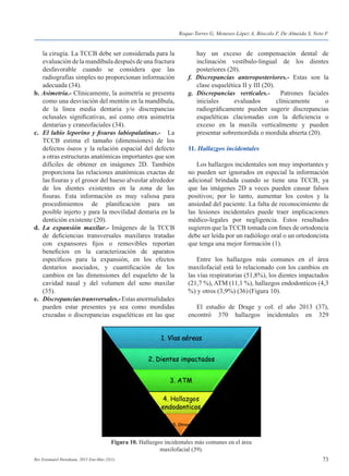 73Rev Estomatol Herediana. 2015 Ene-Mar;25(1).
	 la cirugía. La TCCB debe ser considerada para la
	 evaluación de la mandíbula después de una fractura
	 desfavorable cuando se considera que las
	 radiografías simples no proporcionan información
	 adecuada (34).
b. Asimetría.- Clínicamente, la asimetría se presenta
	 como una desviación del mentón en la mandíbula,
	 de la línea media dentaria y/o discrepancias
	 oclusales significativas, así como otra asimetría
	 dentarias y craneofaciales (34).
c. 	El labio leporino y fisuras labiopalatinas.- La
	 TCCB estima el tamaño (dimensiones) de los
	 defectos óseos y la relación espacial del defecto
	 a otras estructuras anatómicas importantes que son
	 difíciles de obtener en imágenes 2D. También
	 proporciona las relaciones anatómicas exactas de
	 las fisuras y el grosor del hueso alveolar alrededor
	 de los dientes existentes en la zona de las
	 fisuras. Esta información es muy valiosa para
	 procedimientos de planificación para un
	 posible injerto y para la movilidad dentaria en la
	 dentición existente (20).
d. La expansión maxilar.- Imágenes de la TCCB
	 de deficiencias transversales maxilares tratadas
	 con expansores fijos o removibles reportan
	 beneficios en la caracterización de aparatos
	 específicos para la expansión, en los efectos
	 dentarios asociados, y cuantificación de los
	 cambios en las dimensiones del esqueleto de la
	 cavidad nasal y del volumen del seno maxilar
	(35).
e. 	Discrepanciastransversales.-Estasanormalidades
	 pueden estar presentes ya sea como mordidas
	 cruzadas o discrepancias esqueléticas en las que
	 hay un exceso de compensación dental de
	 inclinación vestíbulo-lingual de los dientes
	 posteriores (20).
f. Discrepancias anteroposteriores.- Estas son la
	 clase esquelética II y III (20).
g. 	Discrepancias verticales.- Patrones faciales
	 iniciales evaluados clínicamente o
	 radiográficamente pueden sugerir discrepancias
	 esqueléticas clacionadas con la deficiencia o
	 exceso en la maxila verticalmente y pueden
	 presentar sobremordida o mordida abierta (20).
11. Hallazgos incidentales
	 Los hallazgos incidentales son muy importantes y
no pueden ser ignorados en especial la información
adicional brindada cuando se tiene una TCCB, ya
que las imágenes 2D a veces pueden causar falsos
positivos; por lo tanto, aumentar los costos y la
ansiedad del paciente. La falta de reconocimiento de
las lesiones incidentales puede traer implicaciones
médico-legales por negligencia. Estos resultados
sugieren que la TCCB tomada con fines de ortodoncia
debe ser leída por un radiólogo oral o un ortodoncista
que tenga una mejor formación (1).
	 Entre los hallazgos más comunes en el área
maxilofacial está lo relacionado con los cambios en
las vías respiratorias (51,8%), los dientes impactados
(21,7 %), ATM (11,1 %), hallazgos endodonticos (4,3
%) y otros (3,9%) (36)(Figura 10).
	 El estudio de Drage y col. el año 2013 (37),
encontró 370 hallazgos incidentales en 329
Figura 10. Hallazgos incidentales más comunes en el área
maxilofacial (39).
Roque-Torres G, Meneses-López A, Bóscolo F, De Almeida S, Neto F.
 