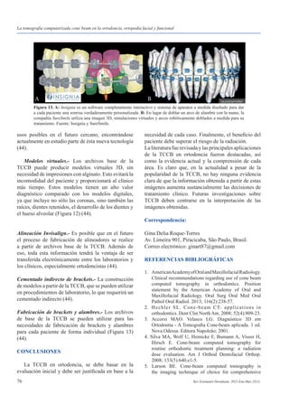 76 Rev Estomatol Herediana. 2015 Ene-Mar;25(1).
usos posibles en el futuro cercano, encontrándose
actualmente en estudio parte de ésta nueva tecnología
(44).
	 Modelos virtuales.- Los archivos base de la
TCCB puede producir modelos virtuales 3D, sin
necesidad de impresiones con alginato. Esto evitará la
incomodidad del paciente y proporcionará al clínico
más tiempo. Estos modelos tienen un alto valor
diagnóstico comparado con los modelos digitales,
ya que incluye no sólo las coronas, sino también las
raíces, dientes retenidos, el desarrollo de los dientes y
el hueso alveolar (Figura 12) (44).
Alineación Invisalign.- Es posible que en el futuro
el proceso de fabricación de alineadores se realice
a partir de archivos base de la TCCB. Además de
eso, toda esta información tendrá la ventaja de ser
transferida electrónicamente entre los laboratorios y
los clínicos, especialmente ortodoncistas (44).
Cementado indirecto de brackets.- La construcción
de modelos a partir de la TCCB, que se pueden utilizar
en procedimientos de laboratorio, lo que requerirá un
cementado indirecto (44).
Fabricación de brackets y alambres.- Los archivos
de base de la TCCB se pueden utilizar para las
necesidades de fabricación de brackets y alambres
para cada paciente de forma individual (Figura 13)
(44).
CONCLUSIONES
	
	 La TCCB en ortodoncia, se debe basar en la
evaluación inicial y debe ser justificada en base a la
Figura 13. A: Insignia es un software completamente interactivo y sistema de aparatos a medida diseñado para dar
a cada paciente una sonrisa verdaderamente personalizada. B: En lugar de doblar un arco de alambre con la mano, la
compañía SureSmile utiliza una imagen 3D, simulaciones virtuales y arcos robóticamente doblados a medida para su
tratamiento. Fuente: Insignia y SureSmile.
necesidad de cada caso. Finalmente, el beneficio del
paciente debe superar el riesgo de la radiación.
Laliteraturafuerevisadaylasprincipalesaplicaciones
de la TCCB en ortodoncia fueron destacadas, así
como la evidencia actual y la comprensión de cada
área. Es claro que, en la actualidad a pesar de la
popularidad de la TCCB, no hay ninguna evidencia
clara de que la información obtenida a partir de estas
imágenes aumenta sustancialmente las decisiones de
tratamiento clínico. Futuras investigaciones sobre
TCCB deben centrarse en la interpretación de las
imágenes obtenidas.
Correspondencia:
Gina Delia Roque-Torres
Av. Limeira 901, Piracicaba, São Paulo, Brasil.
Correo electrónico: ginart87@gmail.com
REFERENCIAS BIBLIOGRÁFICAS
1. 	 AmericanAcademyofOralandMaxillofacialRadiology.
	 Clinical recommendations regarding use of cone beam
	 computed tomography in orthodontics. Position
	 statement by the American Academy of Oral and
	 Maxillofacial Radiology. Oral Surg Oral Med Oral
	 Pathol Oral Radiol. 2013; 116(2):238-57.
2. 	 Hechler SL. Cone-beam CT: applications in
	 orthodontics. Dent Clin NorthAm. 2008; 52(4):809-23.
3. Accorsi MAO. Velasco LG. Diagnóstico 3D em
	 Ortodontia - A Tomografia Cone-beam aplicada. 1 ed.
	 Nova Odessa: Editora Napoleão; 2001.
4. Silva MA, Wolf U, Heinicke F, Bumann A, Visser H,
	 Hirsch E. Cone-beam computed tomography for
	 routine orthodontic treatment planning: a radiation
	 dose evaluation. Am J Orthod Dentofacial Orthop.
	 2008; 133(5):640.e1-5.
5. Larson BE. Cone-beam computed tomography is
	 the imaging technique of choice for comprehensive
La tomografía computarizada cone beam en la ortodoncia, ortopedia facial y funcional
A B
 