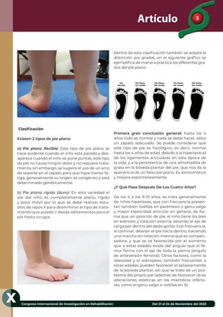 5
Congreso Internacional de Investigación en Rehabilitación Del 21 al 24 de Noviembre del 2023
X
Artículo
Clasiﬁcación
Existen 2 tipos de pie plano:
a) Pie plano ﬂexible: Este tipo de pie plano se
hace evidente cuando el niño está parado y des-
aparece cuando el niño se pone puntas, este tipo
de pie no causa ningún dolor y no requiere trata-
miento, sin embargo, se sugiere el uso de un arco
de soporte en el zapato para que haya menor fa-
tiga, generalmente su origen es congénito y está
determinado genéticamente.
b) Pie plano rígido (duro): En esta variedad el
pie del niño es completamente plano, rígido
y poco móvil por lo que se debe realizar estu-
dios de rayos X para determinar el tipo de trata-
miento que puede ir desde aditamentos para el
pie hasta cirugía.
Dentro de esta clasiﬁcación también se acepta la
distinción por grados, en el siguiente gráﬁco se
ejempliﬁca de manera práctica los diferentes gra-
dos del pie plano:
Primera gran conclusión general: hasta los 4
años todo es normal y nada se debe hacer, salvo
un zapato adecuado. Se puede considerar que
este tipo de pie es ﬁsiológico, es decir, normal
hasta los 4 años de edad, debido a la hiperlaxitud
de los ligamentos articulares en esta época de
la vida, y a la persistencia de una almohadilla de
grasa en la bóveda plantar del pie, que nos da la
apariencia de un falso pie plano. Es asintomático
y mejora espontáneamente.
¿Y Qué Pasa Después De Los Cuatro Años?
De los 4 a los 9-10 años, se trata generalmente
de niños hiperlaxos, que con frecuencia presen-
tan también rodillas en paréntesis o genu valgo
y mayor elasticidad articular en general, de for-
ma que, en posición de pie, el niño tiene los pies
en eversión y rotación externa, estando el eje de
carga por dentro del dedo gordo. Con frecuencia,
al caminar, desvían el pie hacia dentro, haciendo
una marcha en rotación interna que es compen-
sadora, y que se ve favorecida por el aumento
que a estas edades existe del ángulo que el fé-
mur forma con el eje de toda la pierna (ángulo
de anteversión femoral). Otros factores, como la
obesidad y el sobrepeso, también frecuentes a
estas edades, pueden favorecer el aplastamiento
de la bóveda plantar, sin que se trate de un pro-
blema del propio pie (además de favorecer otras
alteraciones estéticas en los miembros inferio-
res, como el genu valgo o rodillas en X).
 