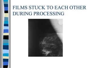 FILMS STUCK TO EACH OTHER
DURING PROCESSING
 