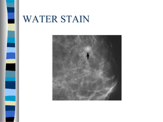 WATER STAIN
 