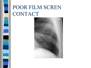 POOR FILM SCREN
CONTACT
 