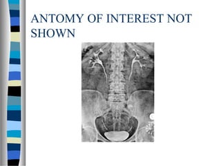 ANTOMY OF INTEREST NOT
SHOWN
 