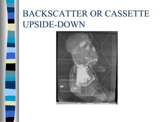 BACKSCATTER OR CASSETTE
UPSIDE-DOWN
 