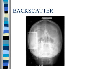 BACKSCATTER
 