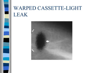 WARPED CASSETTE-LIGHT
LEAK
 