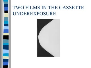 TWO FILMS IN THE CASSETTE
UNDEREXPOSURE
 