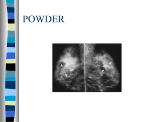 POWDER
 