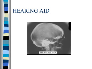 HEARING AID
 