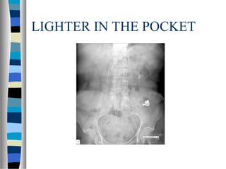 LIGHTER IN THE POCKET
 