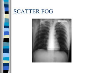 SCATTER FOG
 