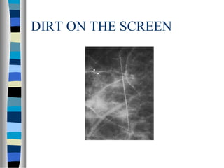 DIRT ON THE SCREEN
 