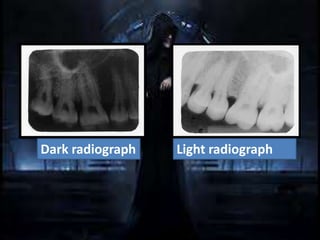 Light Radiograph Iopa Artifact and errors in intraoral periapical radiograph.ppt