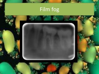 Artifact and errors in intraoral periapical radiograph.ppt