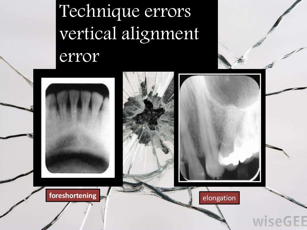 Artifact and errors in intraoral periapical radiograph.ppt