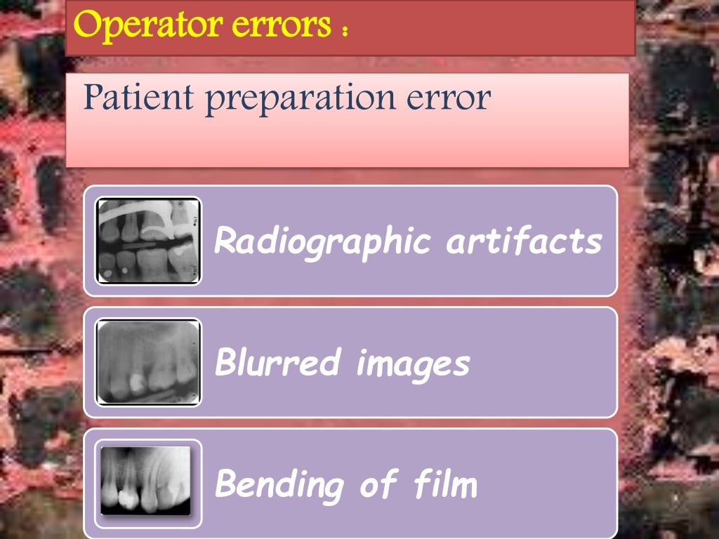 Artifact and errors in intraoral periapical radiograph.ppt