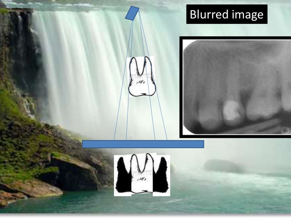 Artifact and errors in intraoral periapical radiograph.ppt