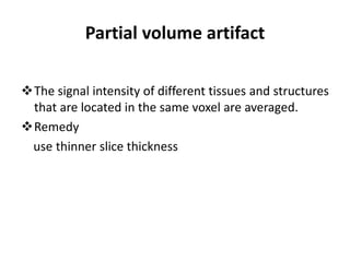 Partial volume artifact
The signal intensity of different tissues and structures
that are located in the same voxel are averaged.
Remedy
use thinner slice thickness
 