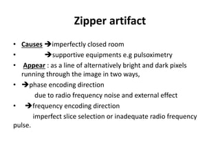 Zipper artifact
• Causes imperfectly closed room
• supportive equipments e.g pulsoximetry
• Appear : as a line of alternatively bright and dark pixels
running through the image in two ways,
• phase encoding direction
due to radio frequency noise and external effect
• frequency encoding direction
imperfect slice selection or inadequate radio frequency
pulse.
 
