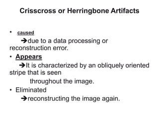 Crisscross or Herringbone Artifacts
• caused
due to a data processing or
reconstruction error.
• Appears
It is characterized by an obliquely oriented
stripe that is seen
throughout the image.
• Eliminated
reconstructing the image again.
 