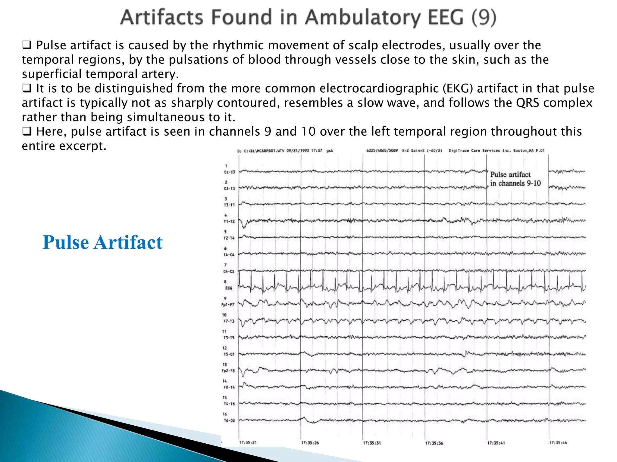 Artifact removal from ambulatory eeg | PPTX