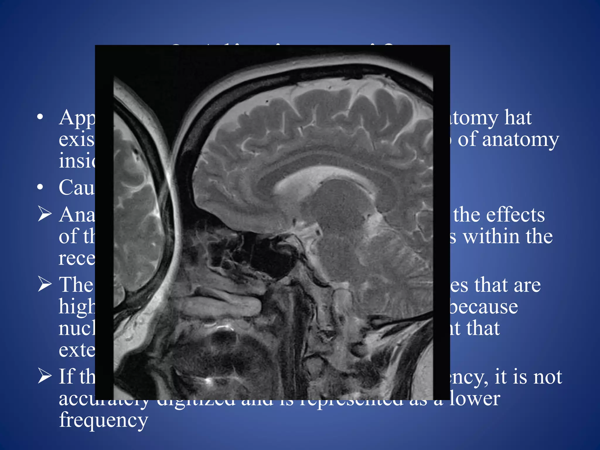 3.Aliasing artifact
• Appearance: appears as the wrap where anatomy hat
exist outside the FOV is folded onto the top of anatomy
inside FOV
• Causes:
 Anatomy outside the FOV still experiences the effects
of the gradients and produces a signal if it is within the
receiving volume of the receiver coil.
 The signal from this anatomy has frequencies that are
higher or lower than those within the FOV because
nuclei are positioned on parts of the gradient that
extend beyond the FOV.
 If the frequency exceeds the Nyquist frequency, it is not
accurately digitized and is represented as a lower
frequency
 