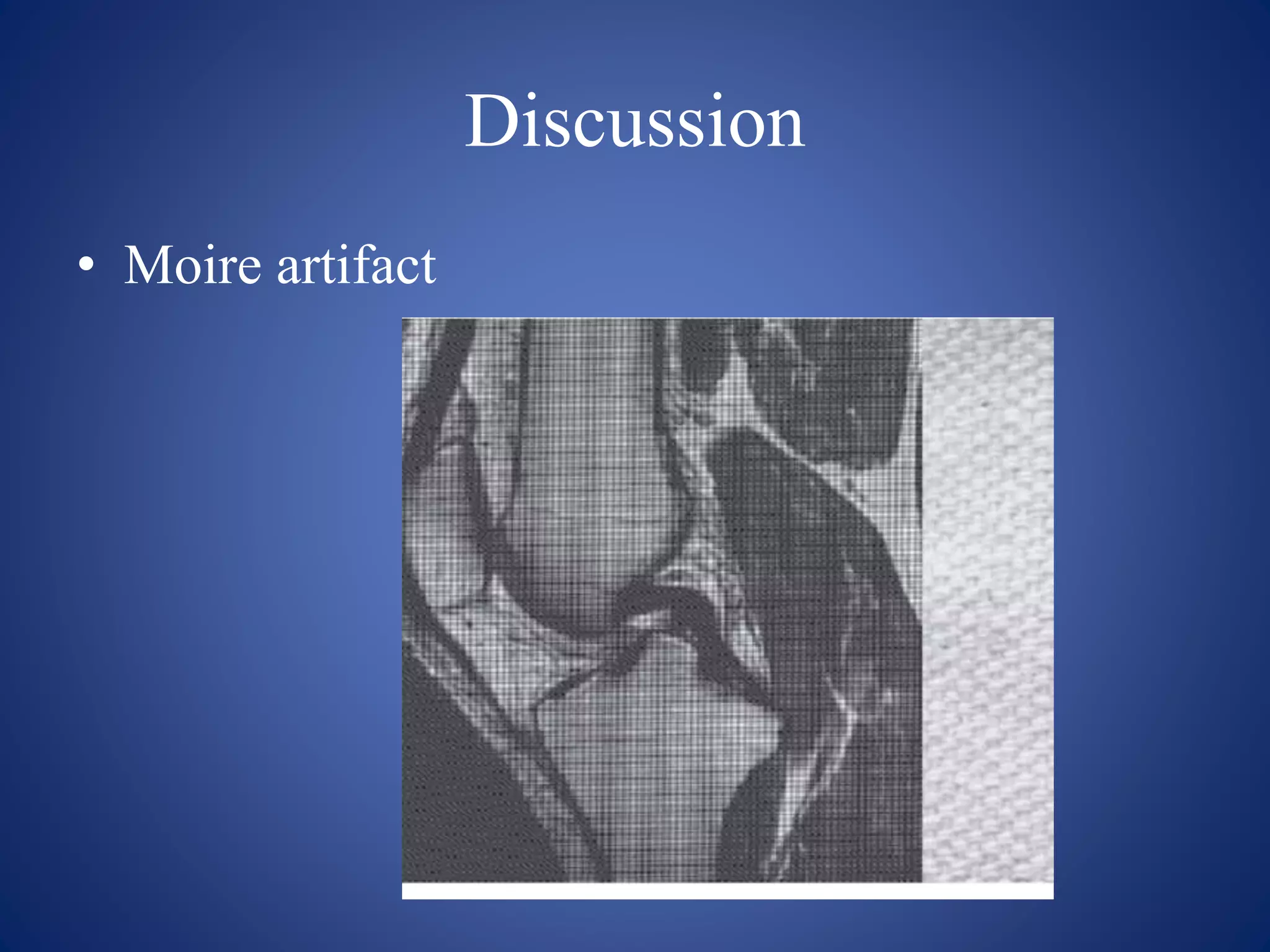 Discussion
• Moire artifact
 