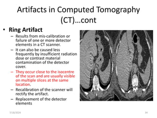 ARTIFACTS IN IMAGING MODALITIES. power ptx | PPTX
