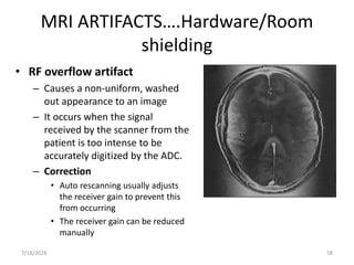 ARTIFACTS IN IMAGING MODALITIES. power ptx | PPTX