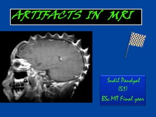Sudil Paudyal
(51)
BSc.MIT Final year
ARTIFACTS IN MRI
 