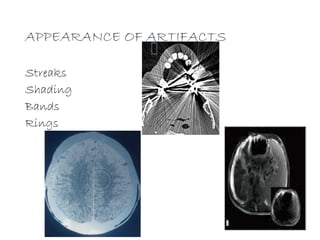 ARTIFACTS IN COMPUTED TOMOGRAPHY_2 (1).pptx