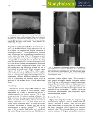 Artifacts In Digital Radiography | PDF