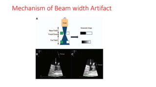 Mechanism of Beam width Artifact
 