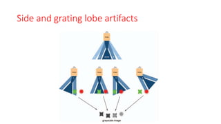 Side and grating lobe artifacts
 